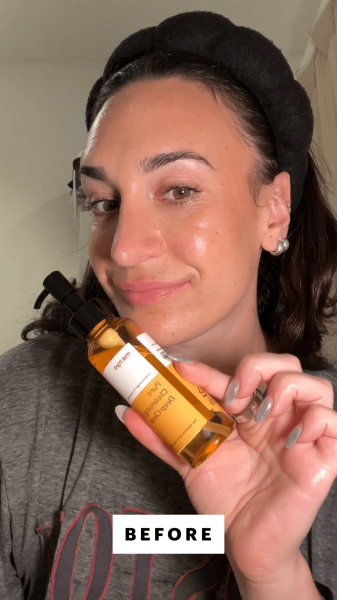 Wohlner before applying the Manyo Pure Cleansing Oil